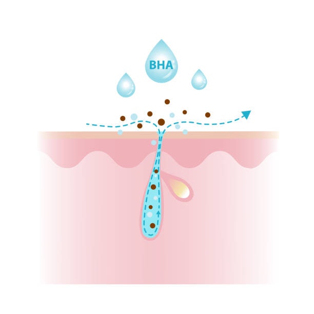 BHA คืออะไร และช่วยแก้ปัญหาผิวอะไรได้บ้าง