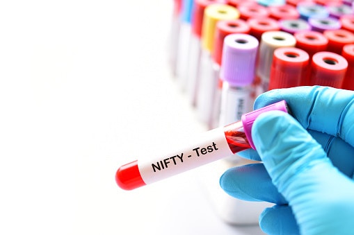 ข้อดีของการตรวจ Nifty เมื่อเทียบกับการตรวจคัดกรองแบบอื่น ๆ