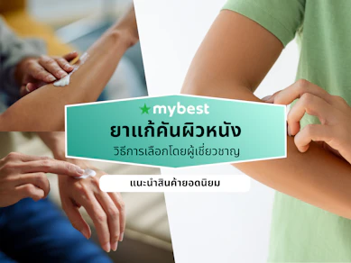 ยาแก้คันผิวหนัง ยี่ห้อไหนดี ปี 2026 แก้ผื่นคัน ผิวหนังอักเสบ