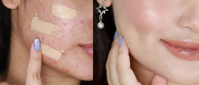 แต่งหน้าปิดสิวแบบไม่โบ๊ะ หน้าใสเนียนกริ๊บ