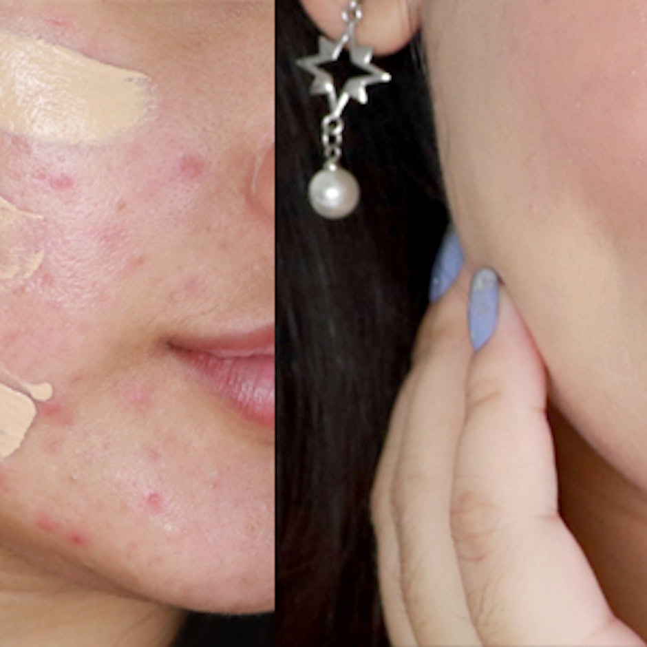 แต่งหน้าปิดสิวแบบไม่โบ๊ะ หน้าใสเนียนกริ๊บ