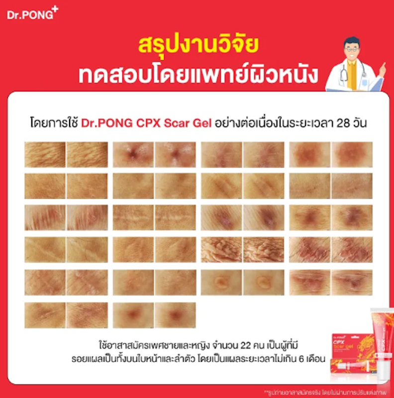 CPX Scar gel 3