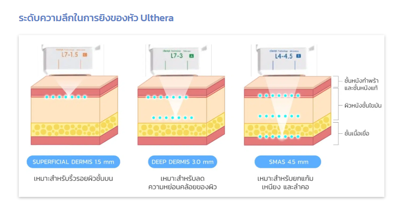 โปรแกรมทำ Ulthera 3
