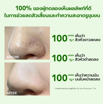 Acneplus Oil Control Clay Mask  2