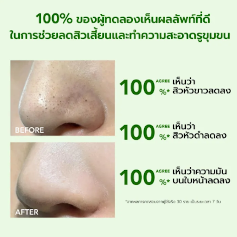 Acneplus Oil Control Clay Mask 2