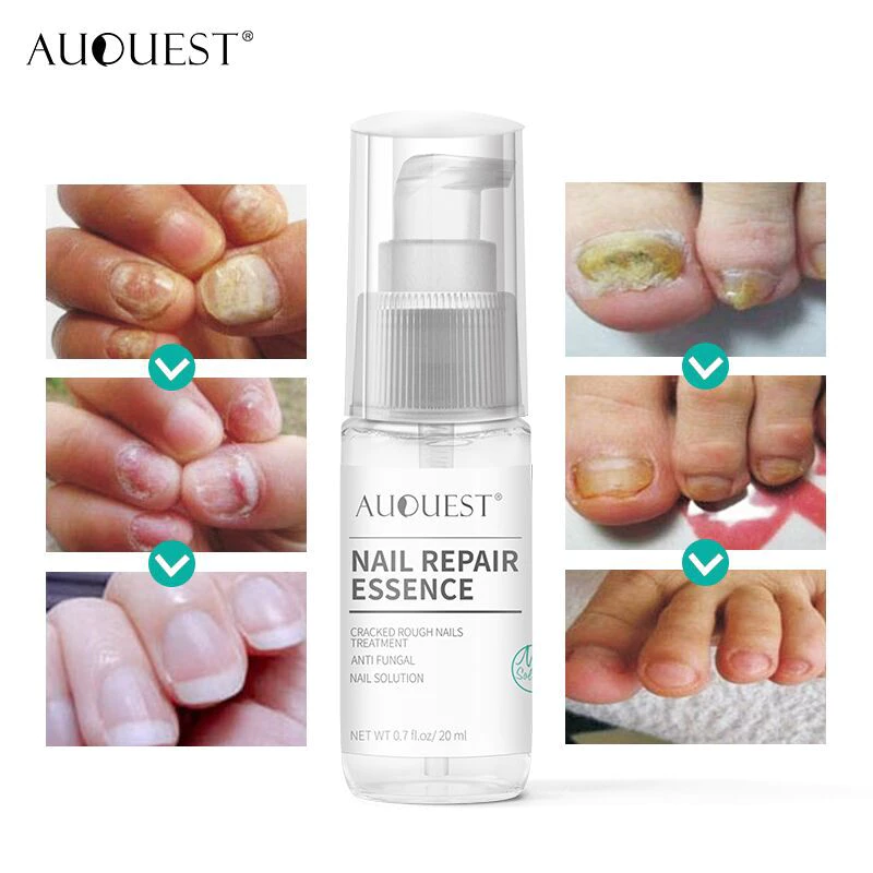 Nail Repair Essence 3
