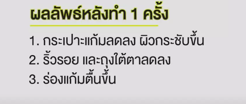 โปรแกรมทำ Ulthera 3