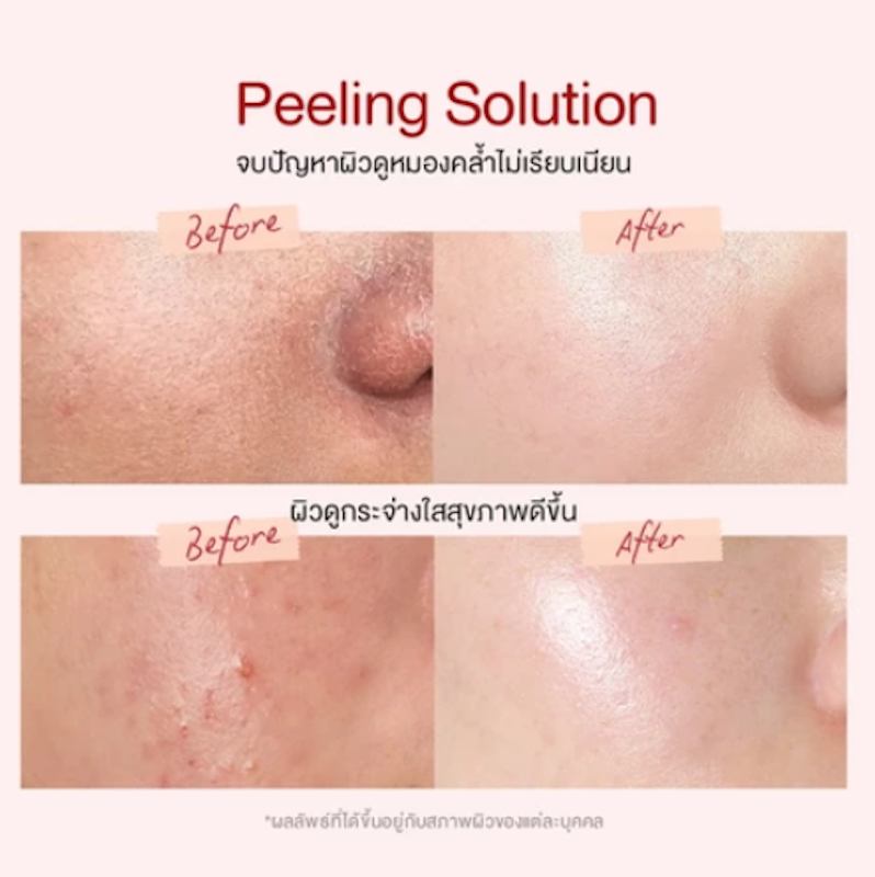 AHA BHA PHA Intensive Peeling Solution Serum 2