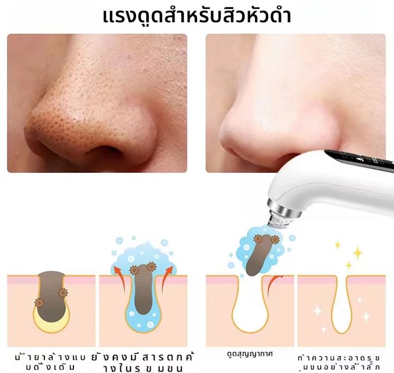เครื่องดูดสิวเสี้ยน 2