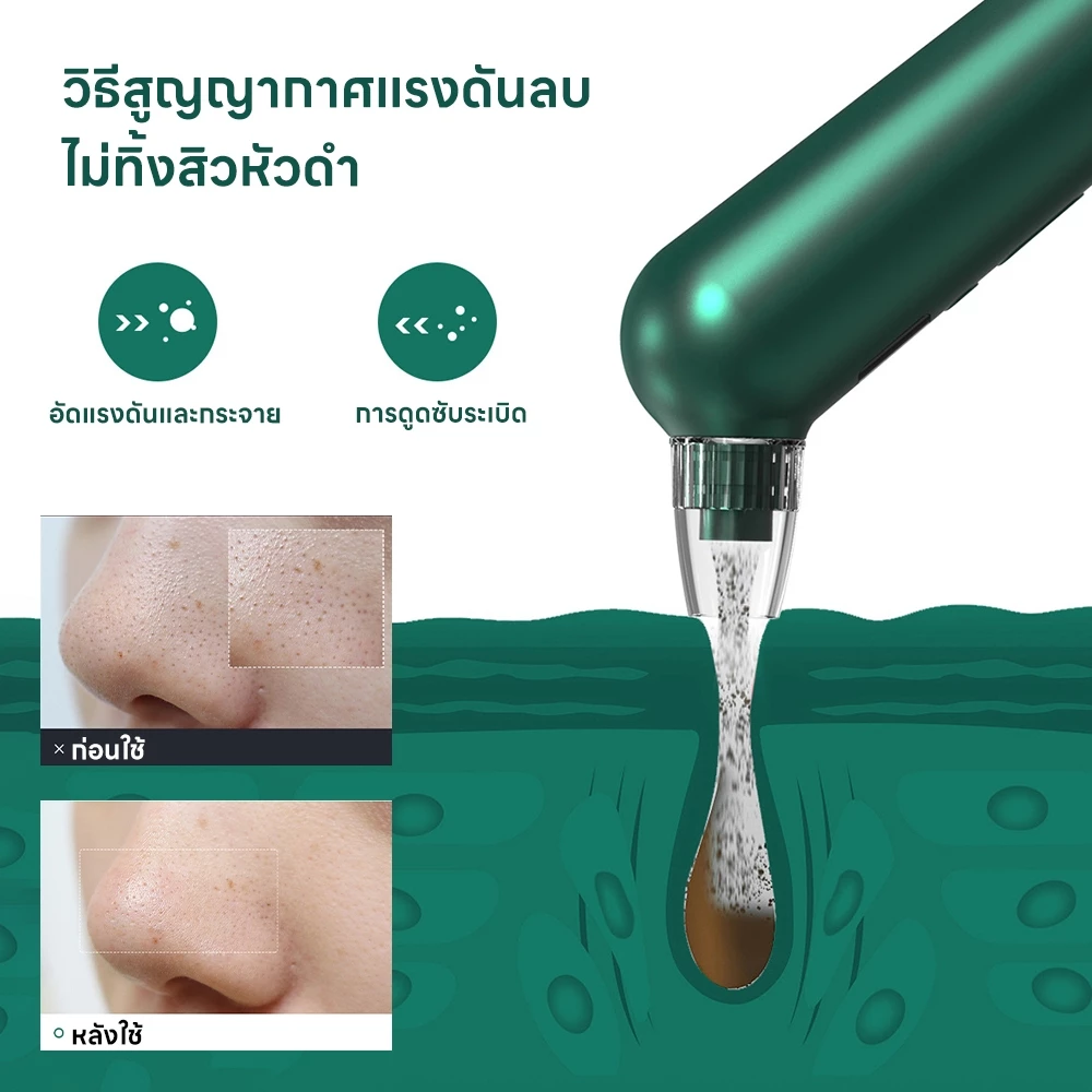 เครื่องดูดสิวเสี้ยน 2