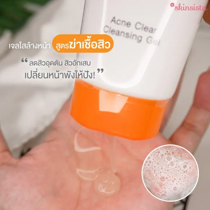 V Acne Clear Cleansing Gel 3