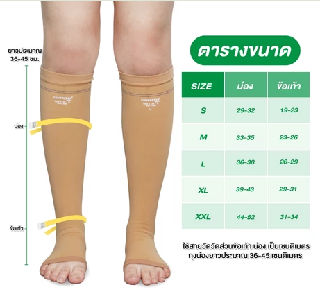 ถุงน่องเส้นเลือดขอด ระดับ 1   2