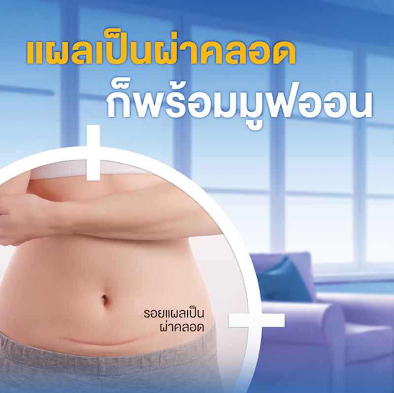 เจลลดรอยแผลเป็น Ultra Gel 3