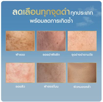 เซรั่ม Luminous 630 Advanced Dark Spot Serum 3
