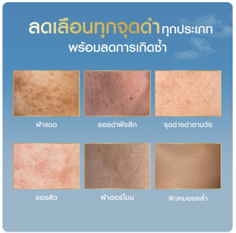 เซรั่ม Luminous 630 Advanced Dark Spot Serum 3