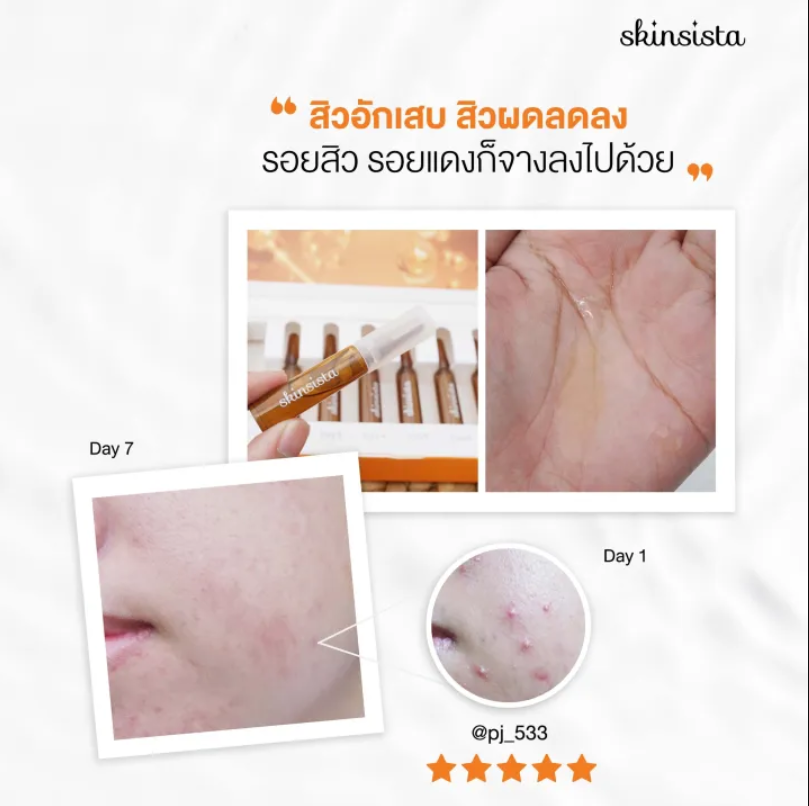 Rescue Anti-Acne Booster 3