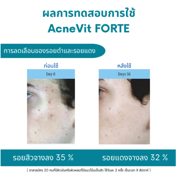 Blemish Antioxidant Serum 3