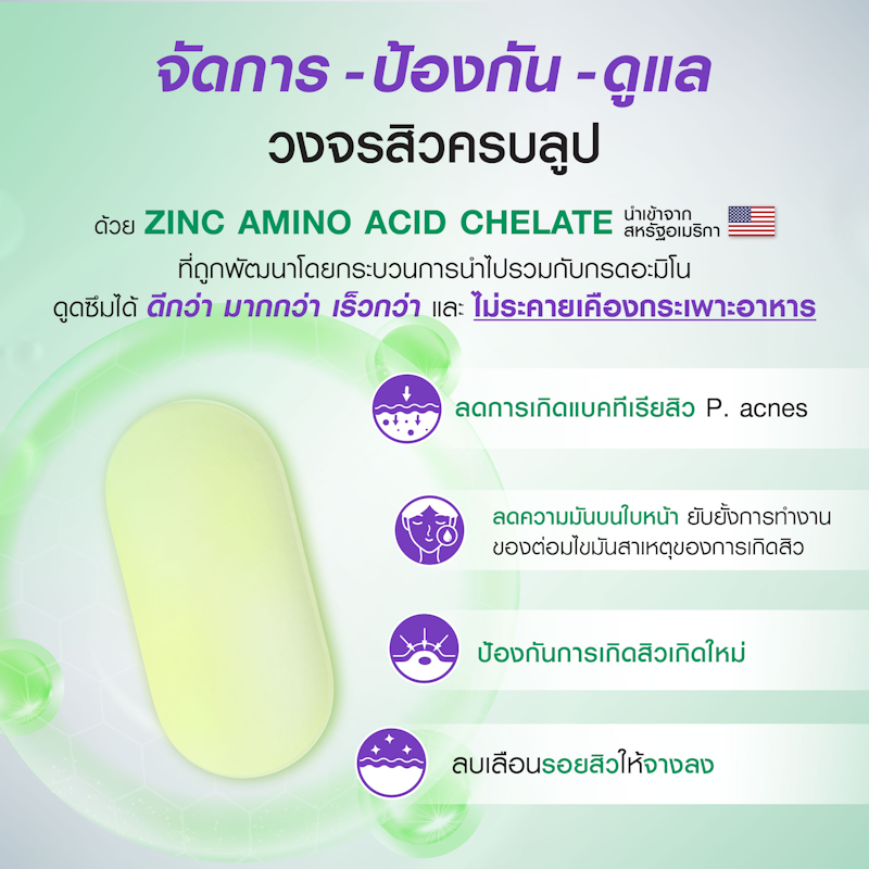 ซิงค์เน่ เอ็กซ์ Zincne 3