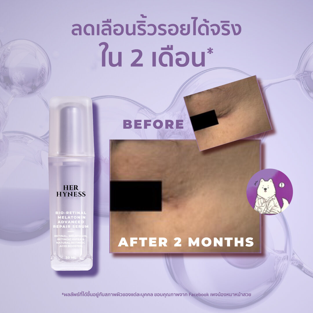 Bio - Retinal Melatonin Advanced Repair Serum 3