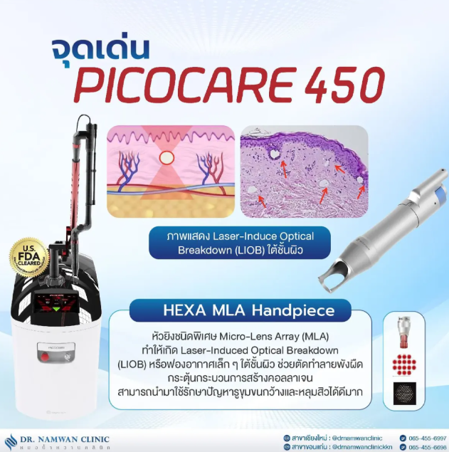 เลเซอร์หน้าใส Program PicoSecond Laser 2