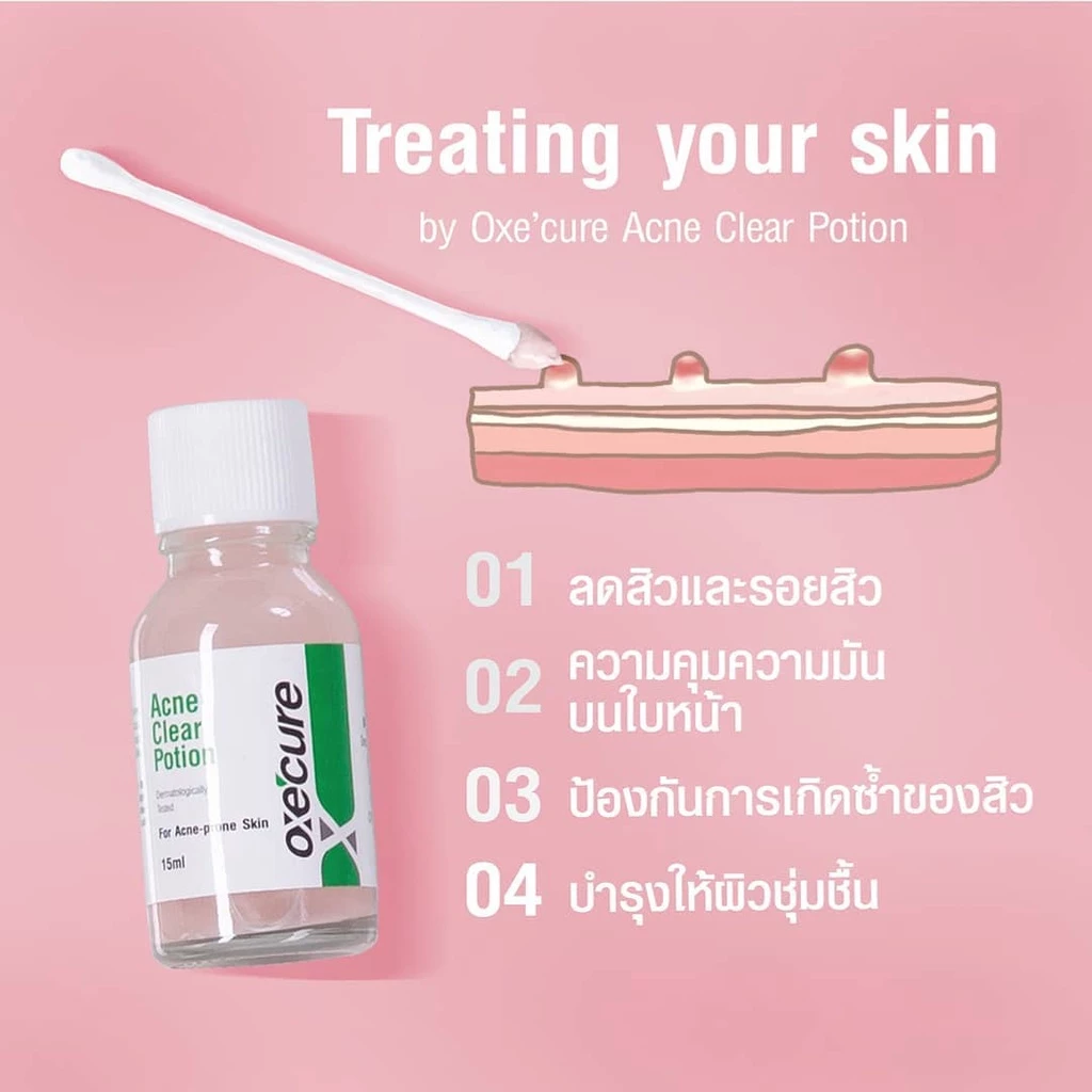 Acne Clear Potion   3