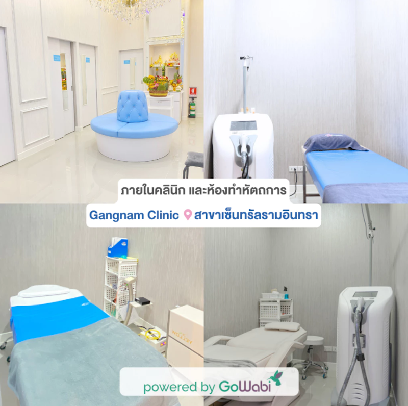 โปรแกรมเลเซอร์กำจัดขน Advance Diode 3 พลังงาน บริเวณรักแร้ 12 ครั้ง 4