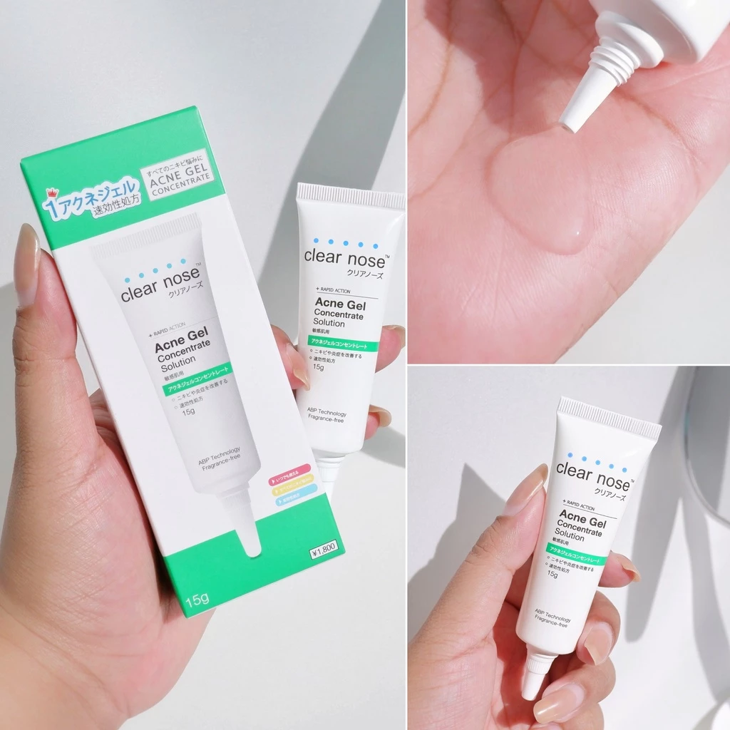 Acne Gel   3