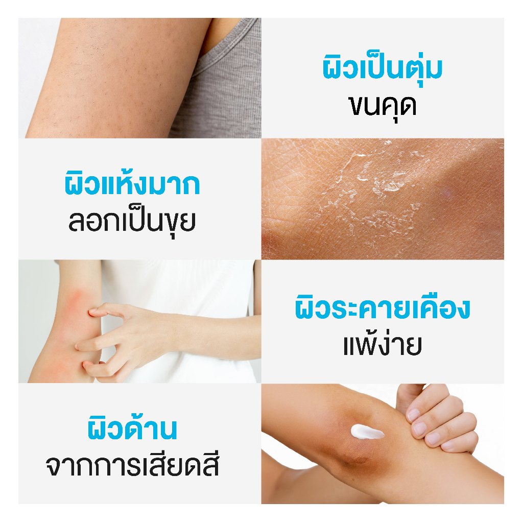 ครีมแก้ผิวแห้งลอก U9.9 RENEWAL CREAM 2