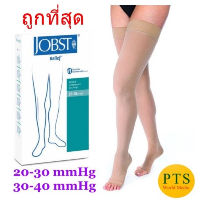 ถุงน่องเส้นเลือดขอด ระดับต้นขา 2