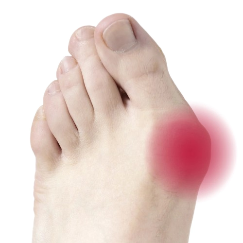 Footcare Gel Toe Spreader & Bunion Protector 2