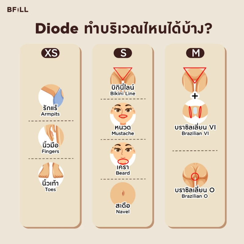 Hair Removal Diode Size XS รักแร้ 6 ครั้ง 3