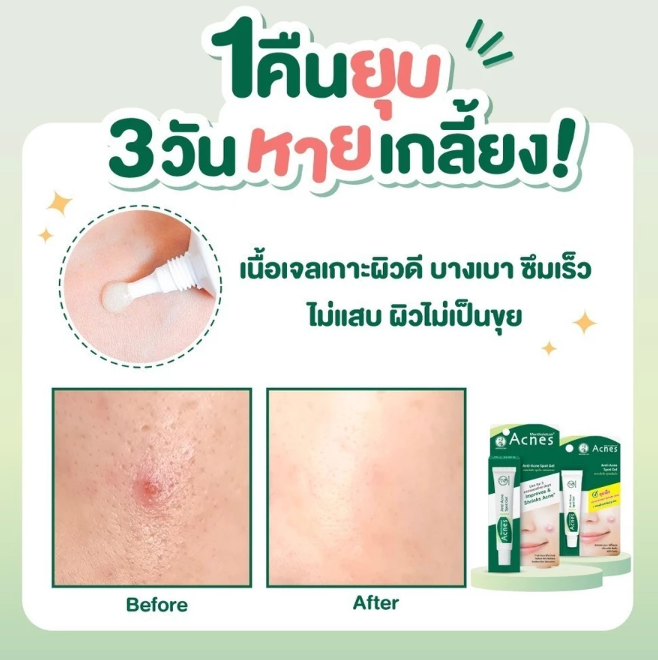 Acnes Anti-Acne Spot Gel 3