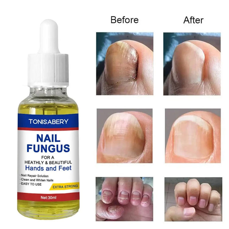 Nail Repair Essence Serum 2