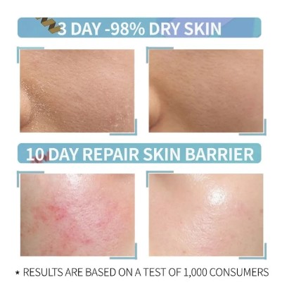 Hyaluronic Acid 2% + B5 3