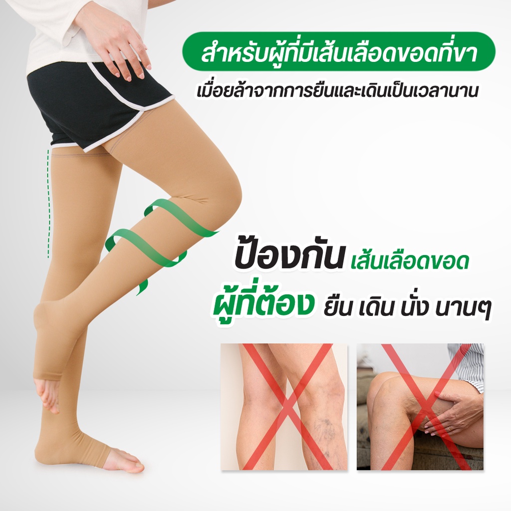 Comprezon Varicose Vein Stockings Class 2 2