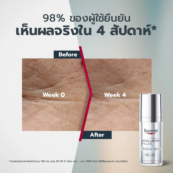 เซรั่ม Hyaluron - Filler Epicelline Serum 3