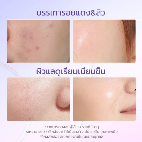 Blueberry Ceramide Moisturizer 3