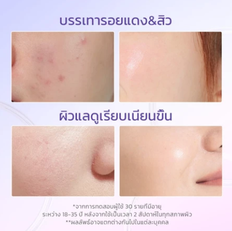 Blueberry Ceramide Moisturizer 3