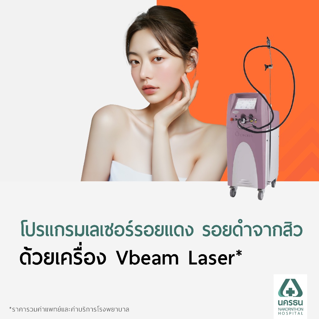 VBeam Laser 2