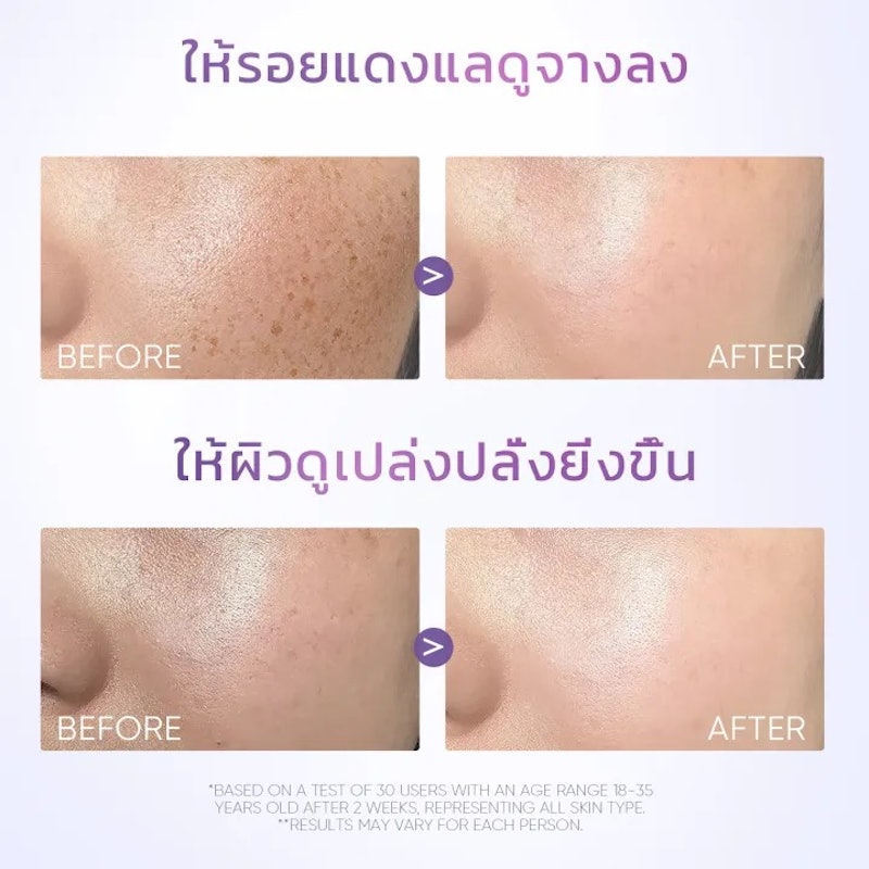 Symwhite377 Dark Spot Moisture Gel 3