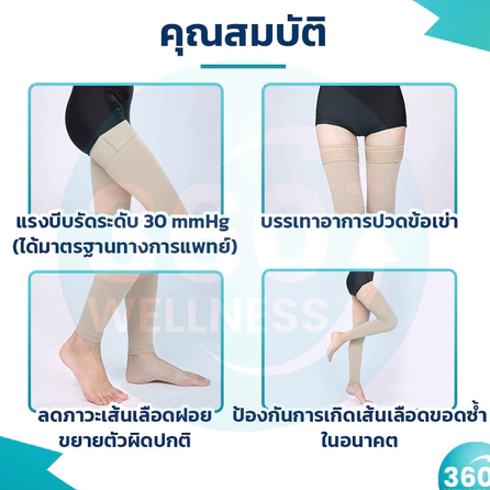 ถุงน่องเส้นเลือดขอด 3