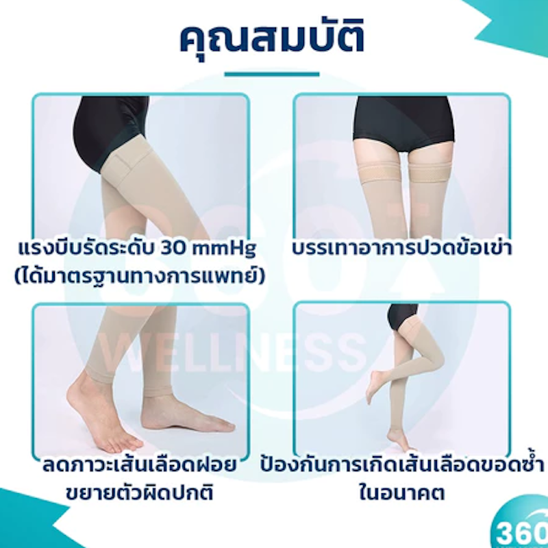 ถุงน่องเส้นเลือดขอด 3