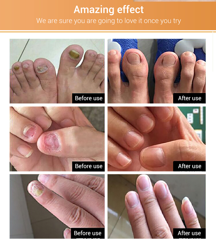 Nail Repair Essence 3