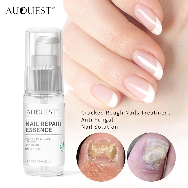 Nail Repair Essence 2