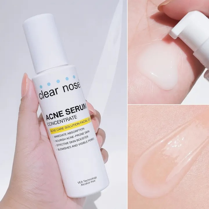 Acne Care Solution Serum 3