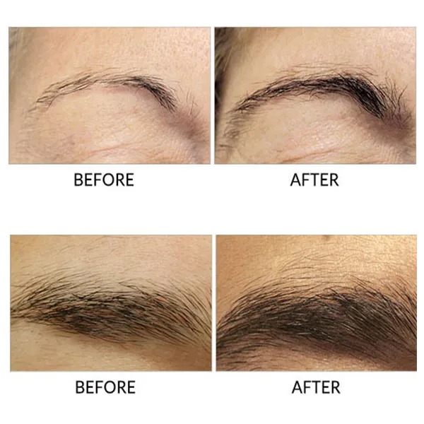 เซรั่มบำรุงขนคิ้ว สูตรเข้มข้น  Eyebrow Enhancing Serum 3