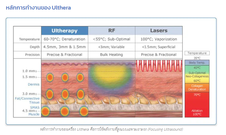 โปรแกรมทำ Ulthera 2