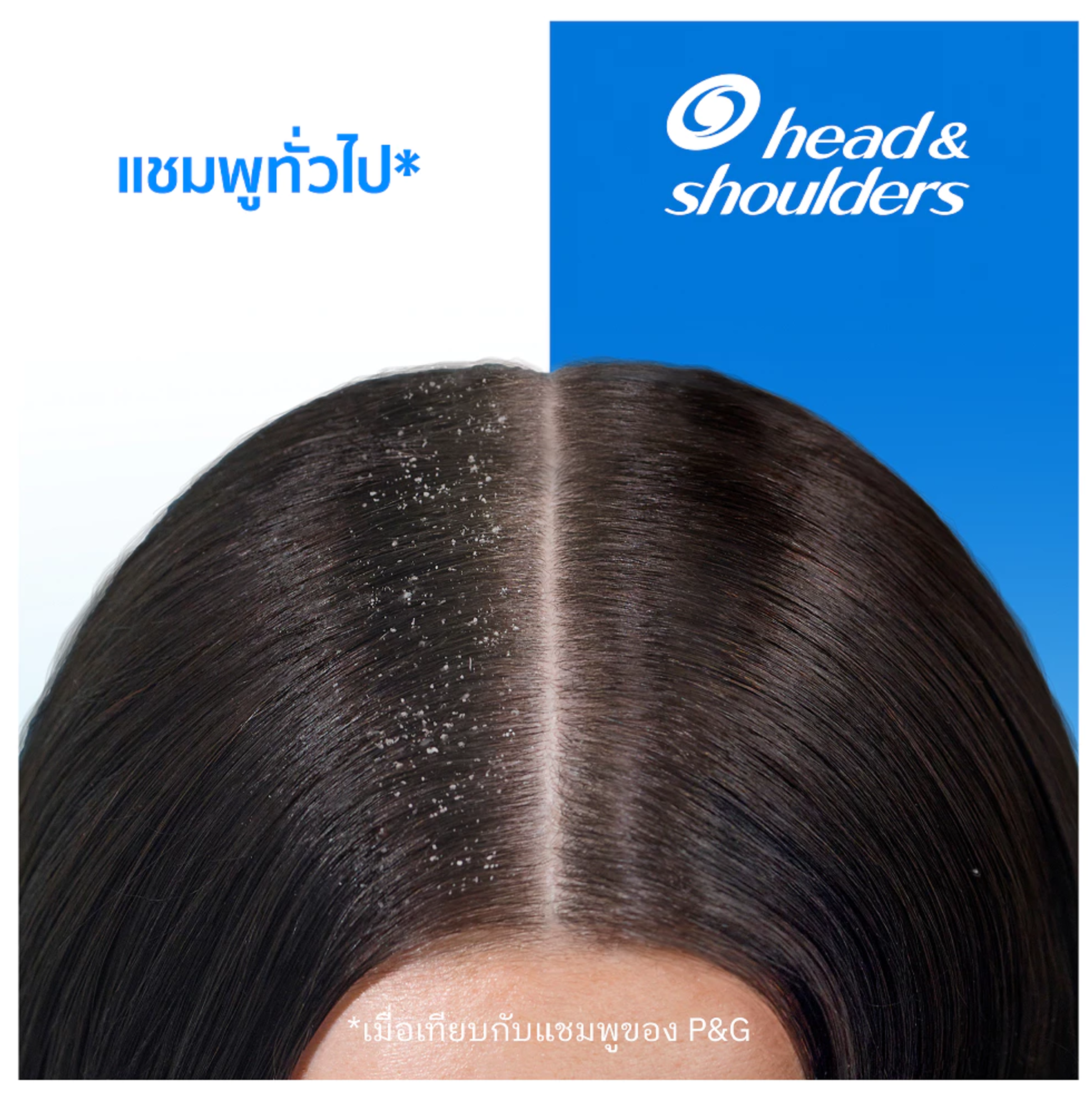 Anti Dandruff Shampoo Cool Menthol  3