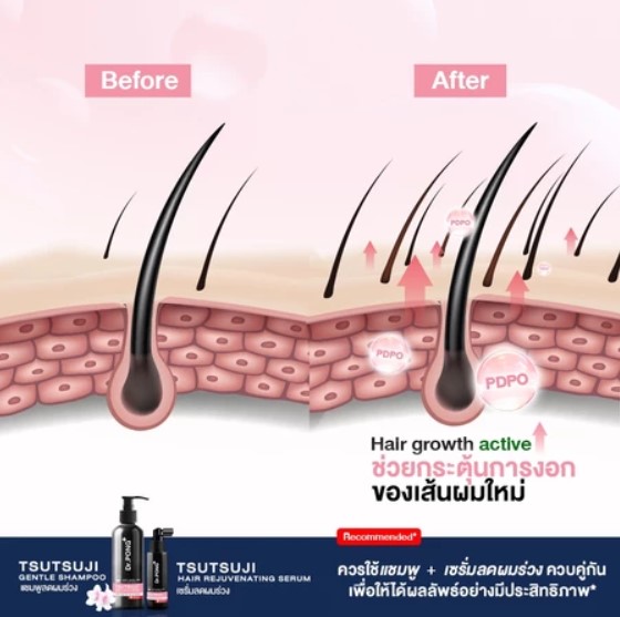 Tsutsuji Hair Rejuvenating Serum Anti-Hairloss Serum 2