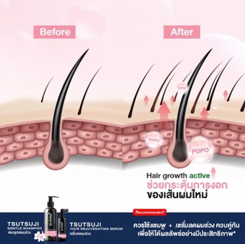 Tsutsuji Hair Rejuvenating Serum Anti-Hairloss Serum 2